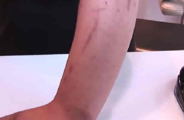 매일 인스턴트 음식만 먹은 20대 남자의 몸 상태